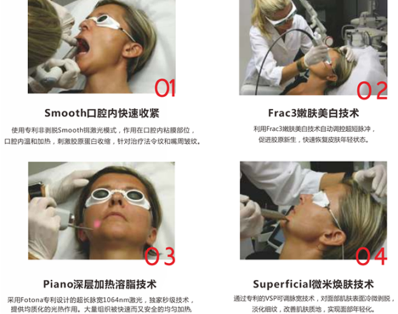 Fotona 4D Pro极塑提拉，面颈眼全层抗衰